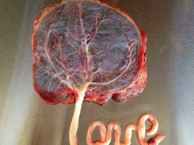 Snakes, Trees, and&nbsp;Fire